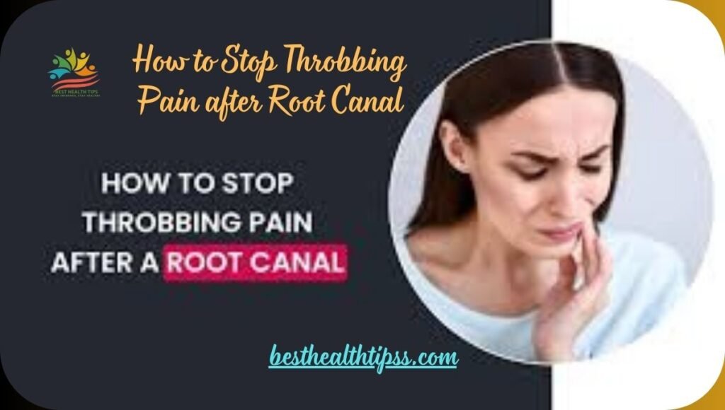 How to Stop Throbbing Pain After Root Canal?