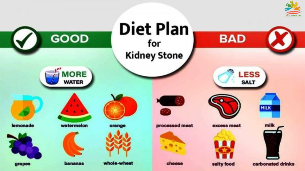 is carnivore diet bad for kidney stoens